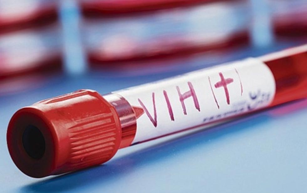 Garantizan medicamento para pacientes con VIH-Sida