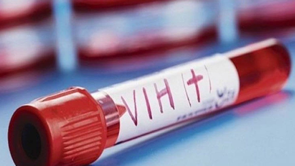 CNDH exhorta a garantizar atención a persona con VIH/Sida